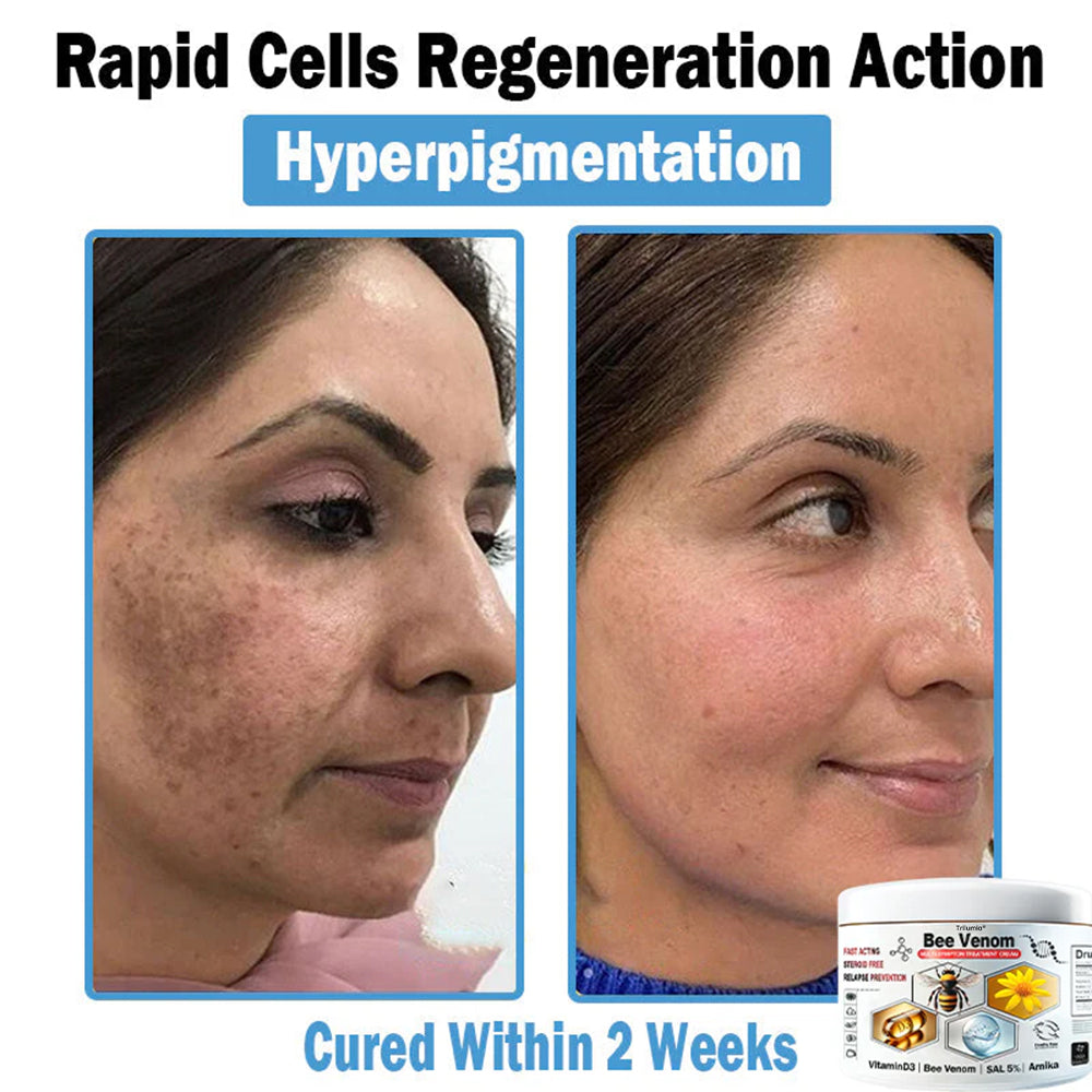 Trilumia® Bee Venom Multi-Symptom Skin Treatment Cream (👨‍⚕BAD RECOMMENDS)