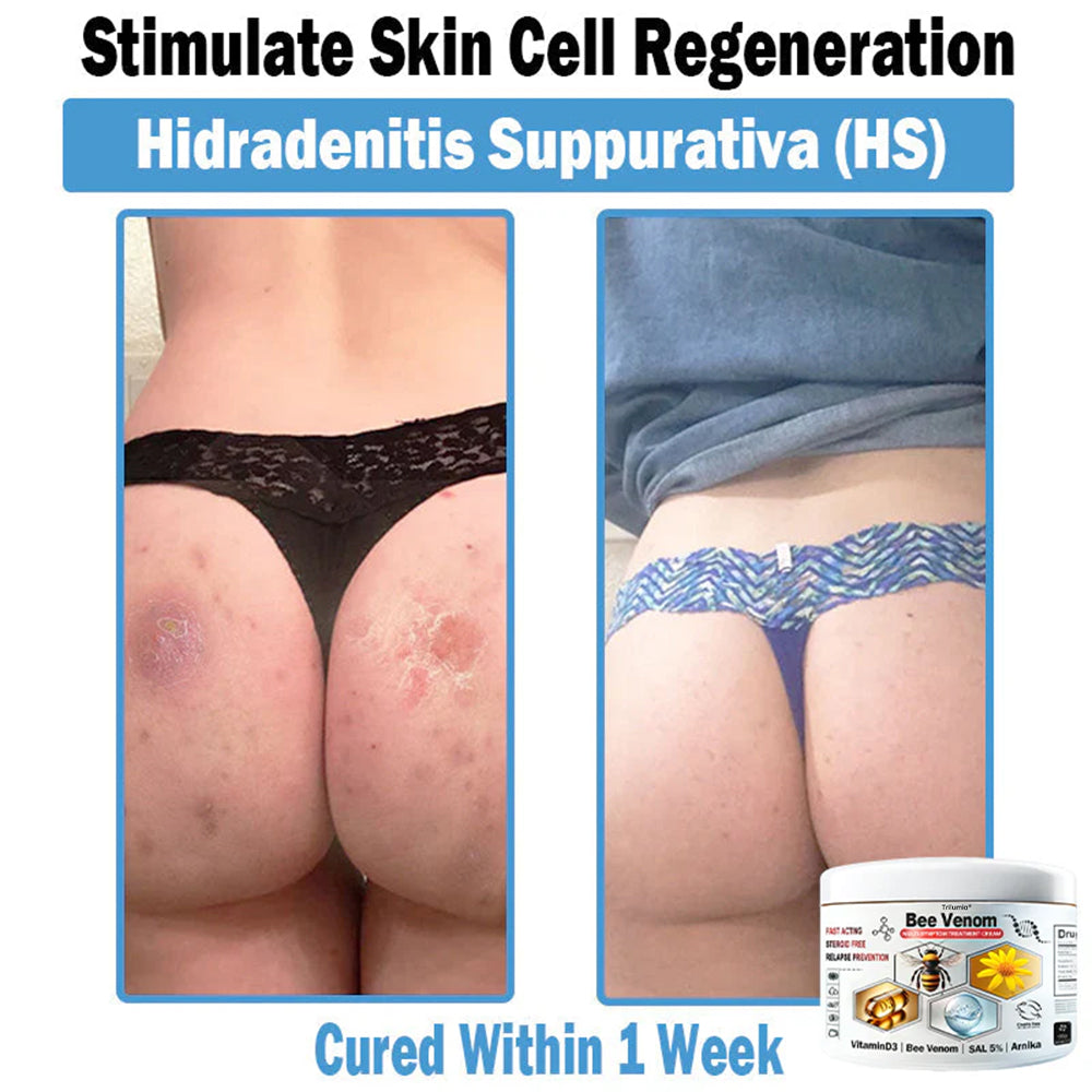 Trilumia® Bee Venom Multi-Symptom Skin Treatment Cream (👨‍⚕BAD RECOMMENDS)