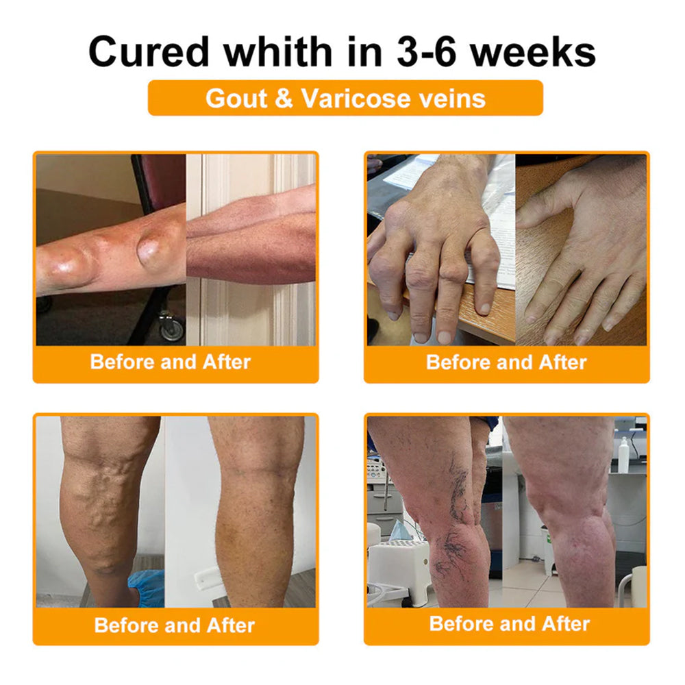 Trilumia® Botulinum Toxin & Bee Venom Pain-Relief Bone Healing Cream🌟