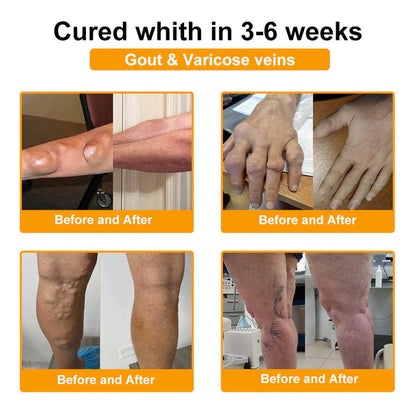 Trilumia® Botulinum Toxin & Bee Venom Pain-Relief Bone Healing Cream🌟