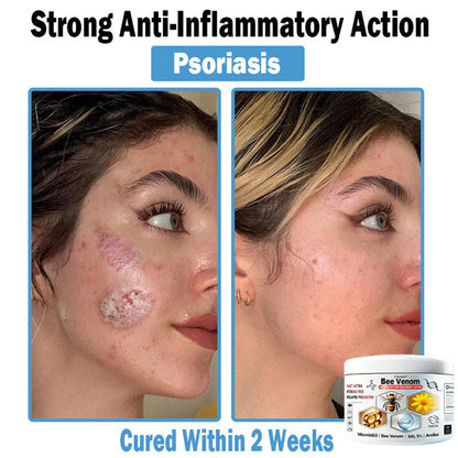 Trilumia® Bee Venom Multi-Symptom Skin Treatment Cream (👨‍⚕BAD RECOMMENDS)