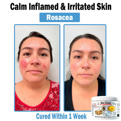Trilumia® Bee Venom Multi-Symptom Skin Treatment Cream (👨‍⚕BAD RECOMMENDS)